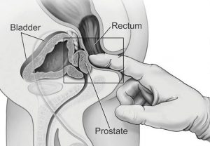 Male Prostate Orgasm - Anal Orgasm For Men | Prostate Orgasm | The Male G-Spot - The Lovers' Guide